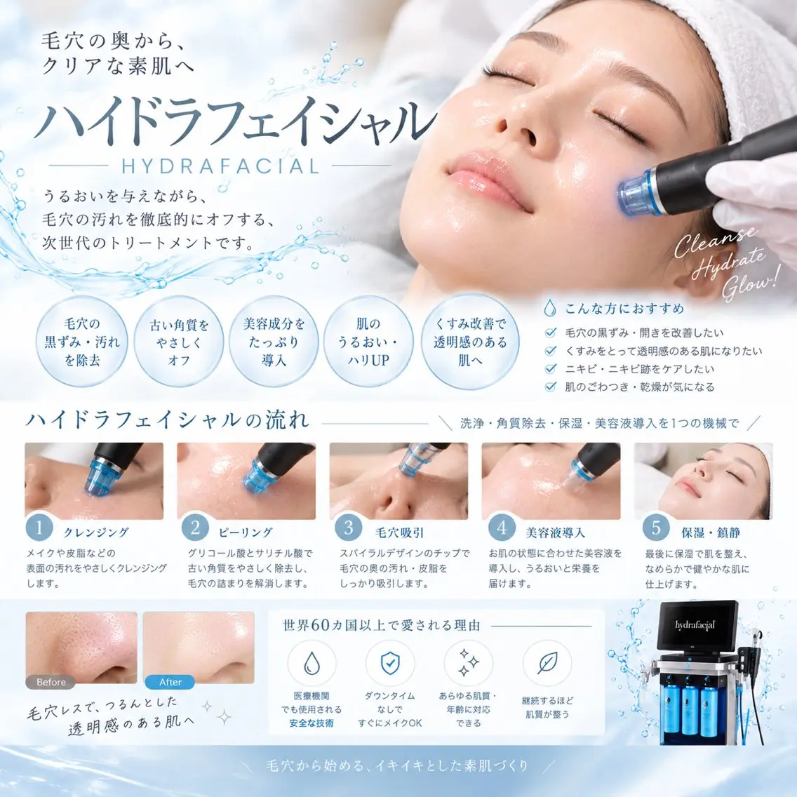 エステ リラク 毛穴・肌質改善サロン réposのその他イメージ