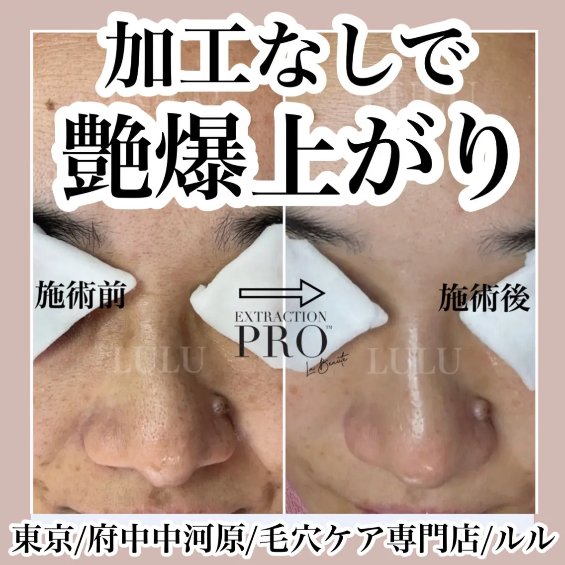 その他 LULU ルルのエステ・リラクイメージ