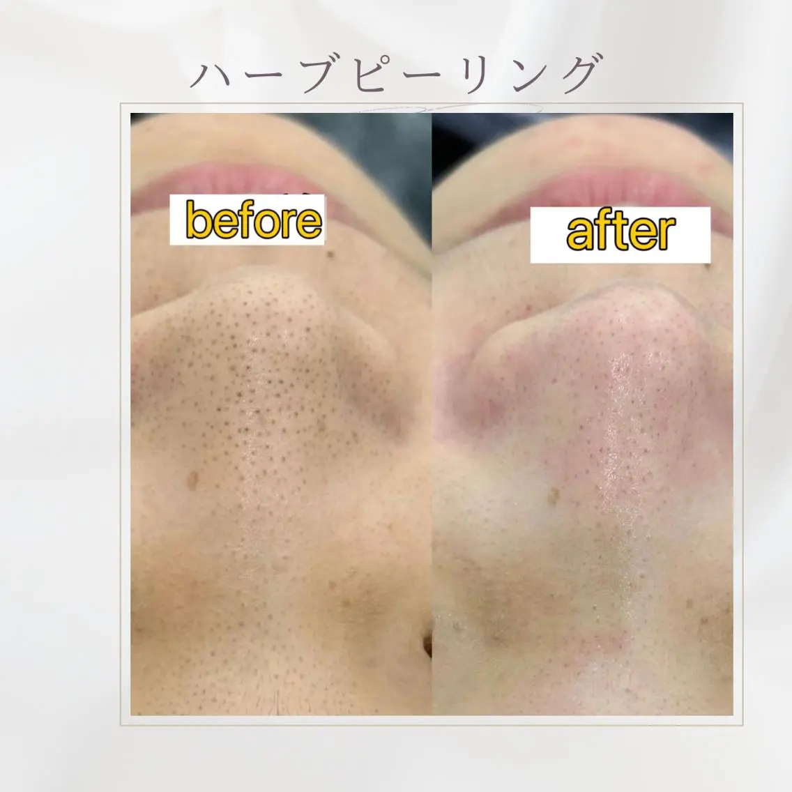 西区九条エステ MITUREIサロンのエステ・リラクイメージ