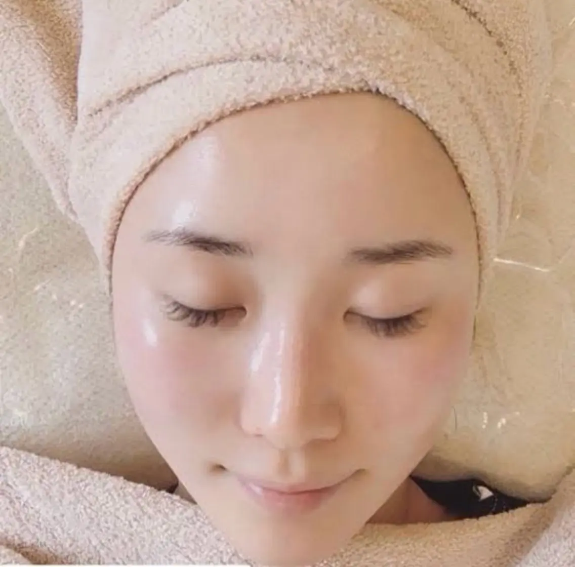 ¥12,000▶︎¥7,700!!!✨艶肌Wax脱毛✨お顔が艶々に!!!の写真