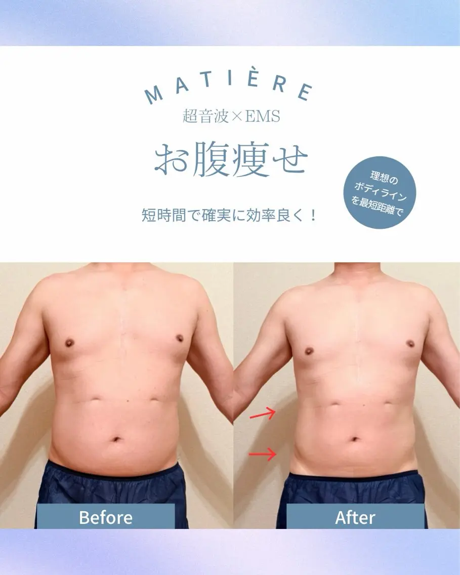 エステ 痩身&アロマリンパ 🌿MATIÈREのエステ・リラクイメージ