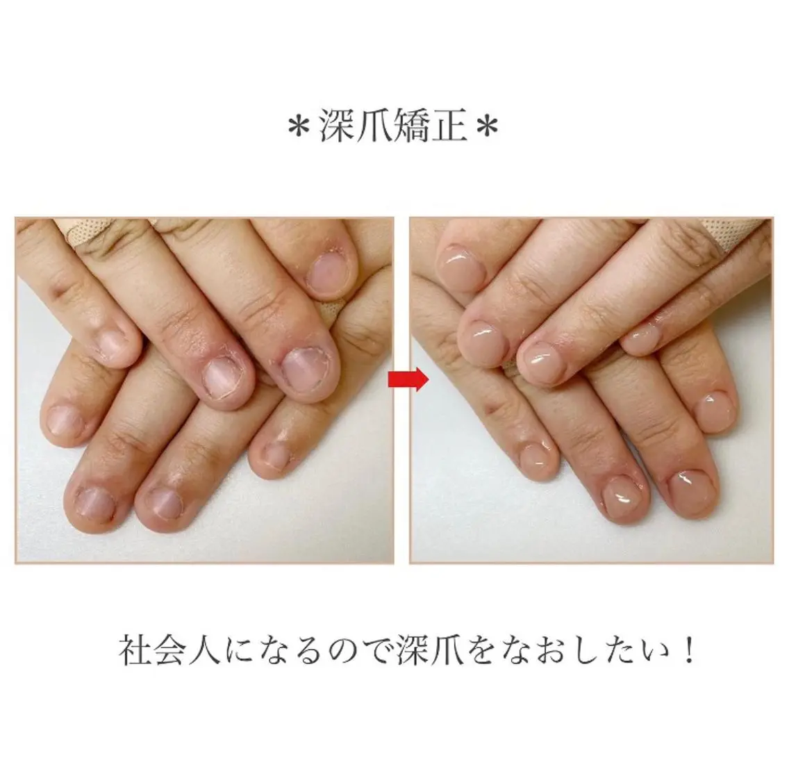ネイル ネイルサロン アリュームのネイルデザイン
