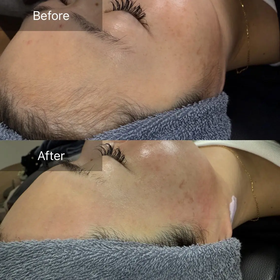 脱毛 enine フェイスWAXのエステ・リラクイメージ