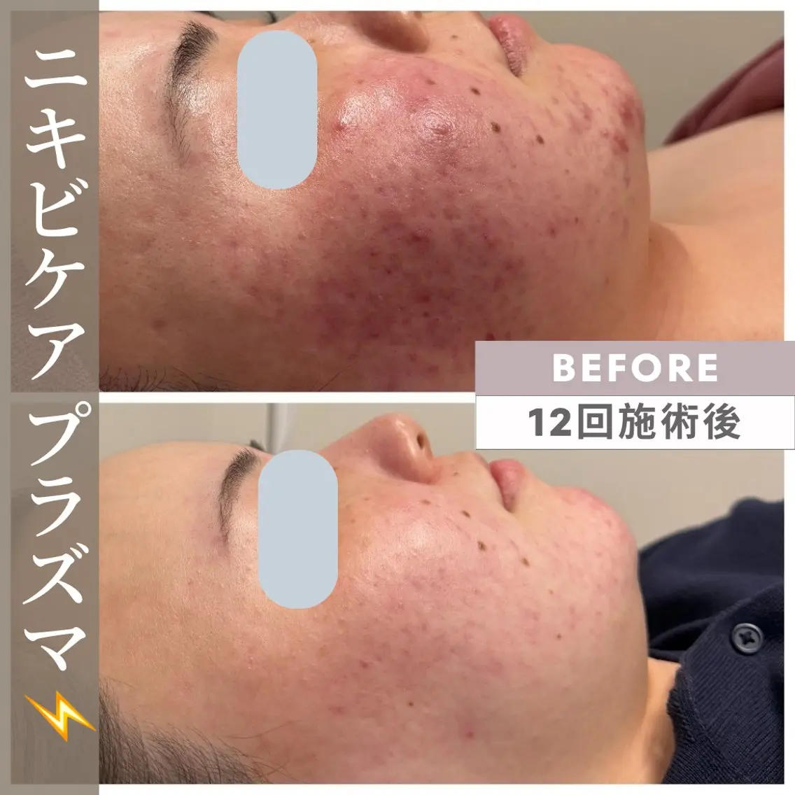 エステ リラク 小顔矯正・美肌ケア 池田 桃花のエステ・リラクイメージ