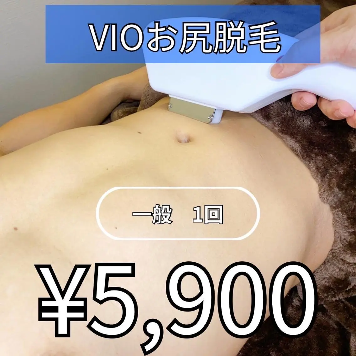 【男性専用】VIOお尻脱毛１回5900円の写真