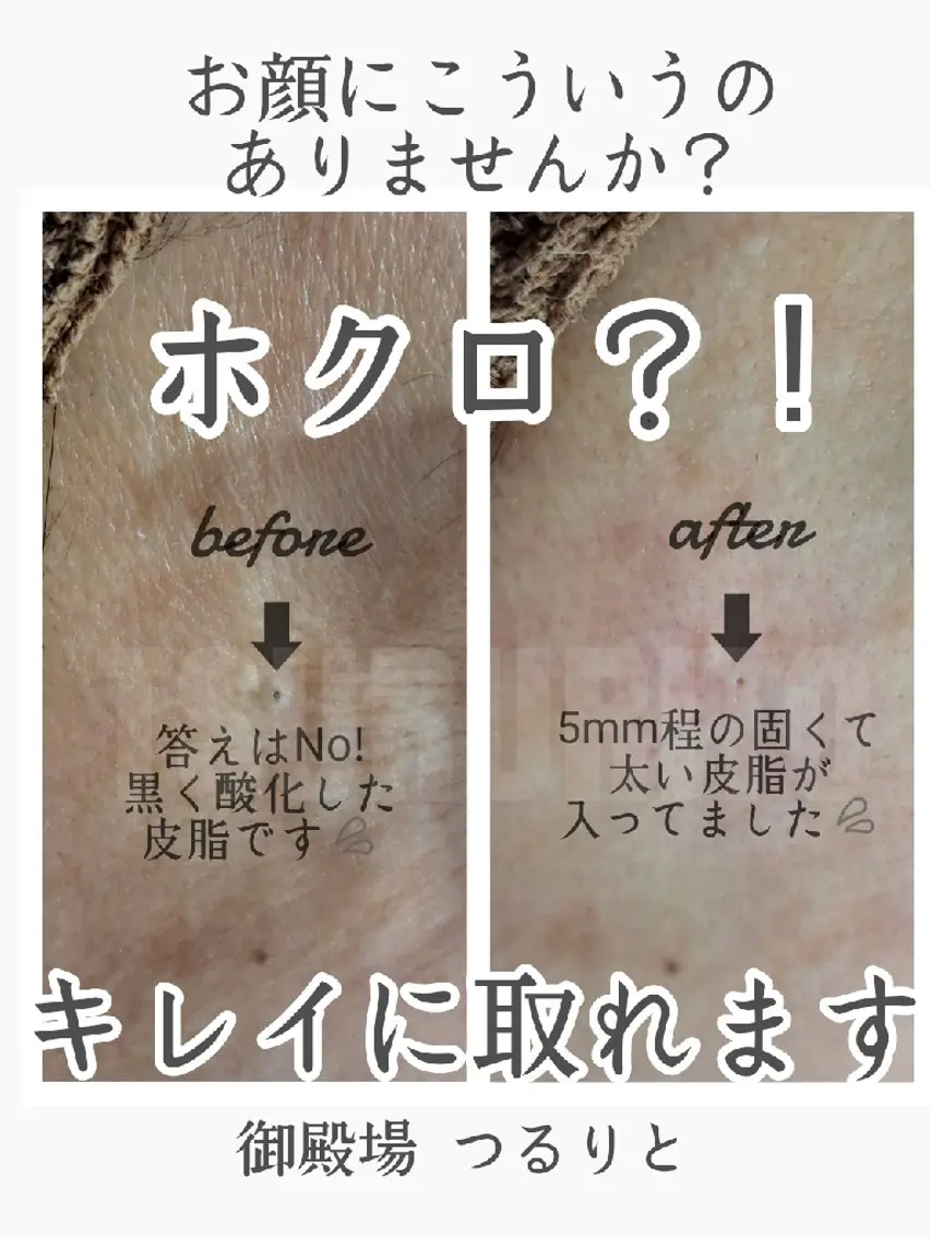 エステサロン LYSH愛名のエステ・リラクイメージ