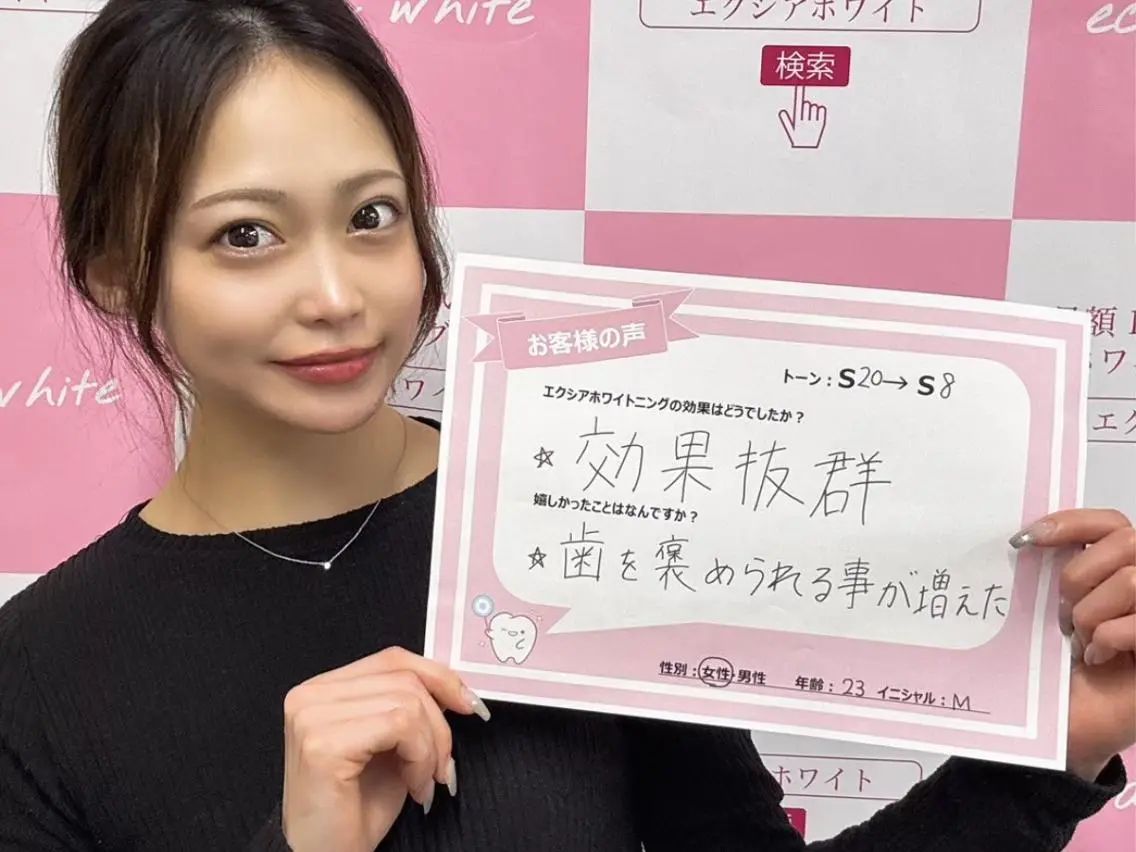 ☆お得な回数券　セルフホワイトニング照射9分×12回分29,880円→26,280円の写真