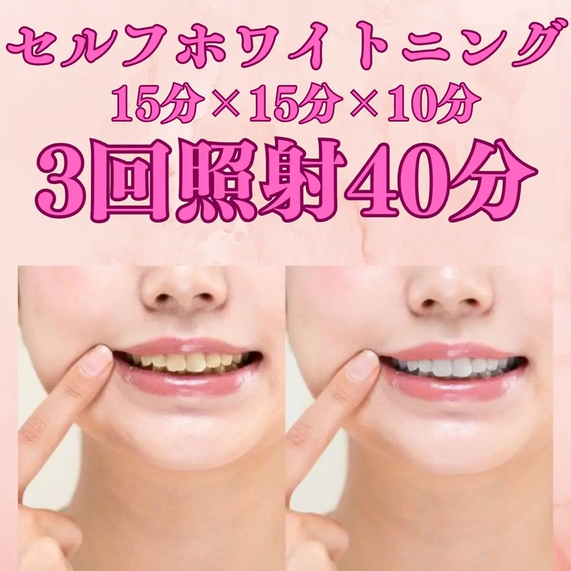 メンズ soerute スタッフemiのエステ・リラクイメージ