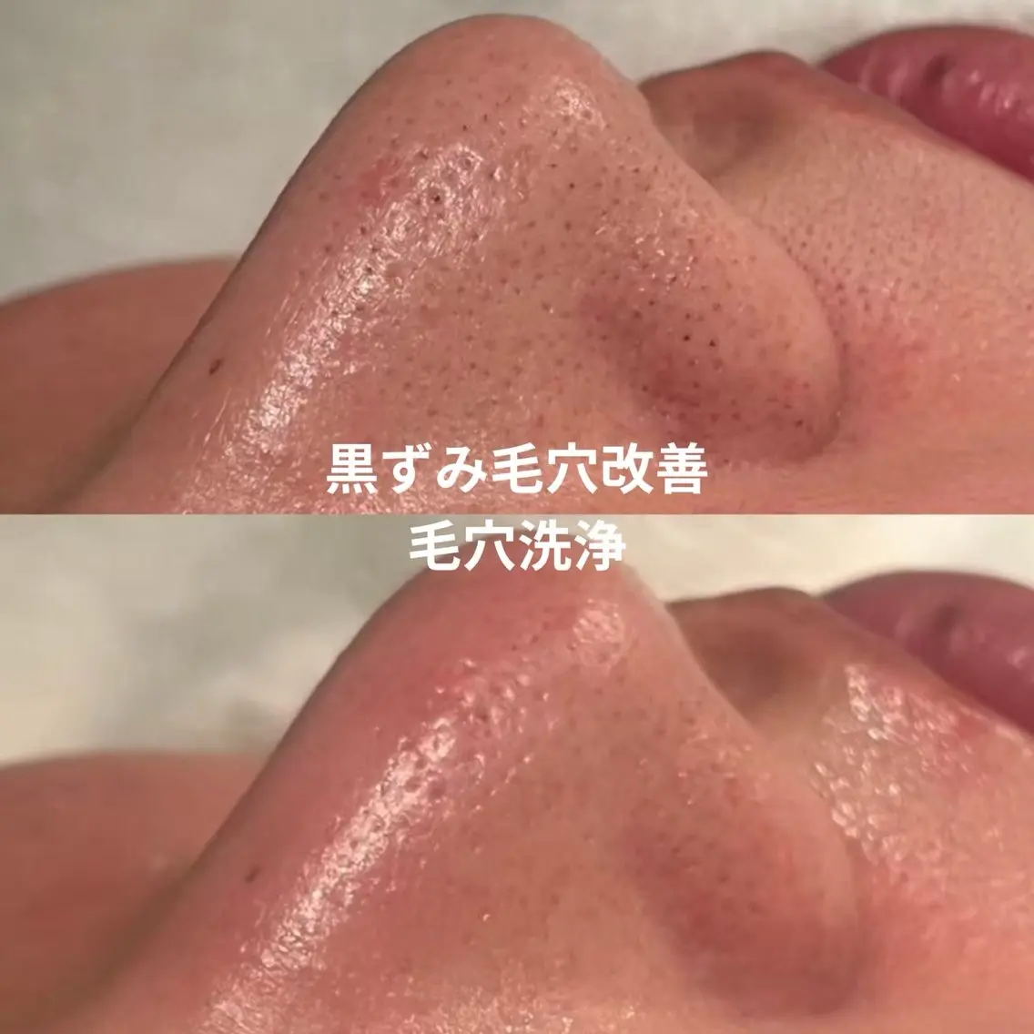 【LEPUS】レプス nishimoriのエステ・リラクイメージ