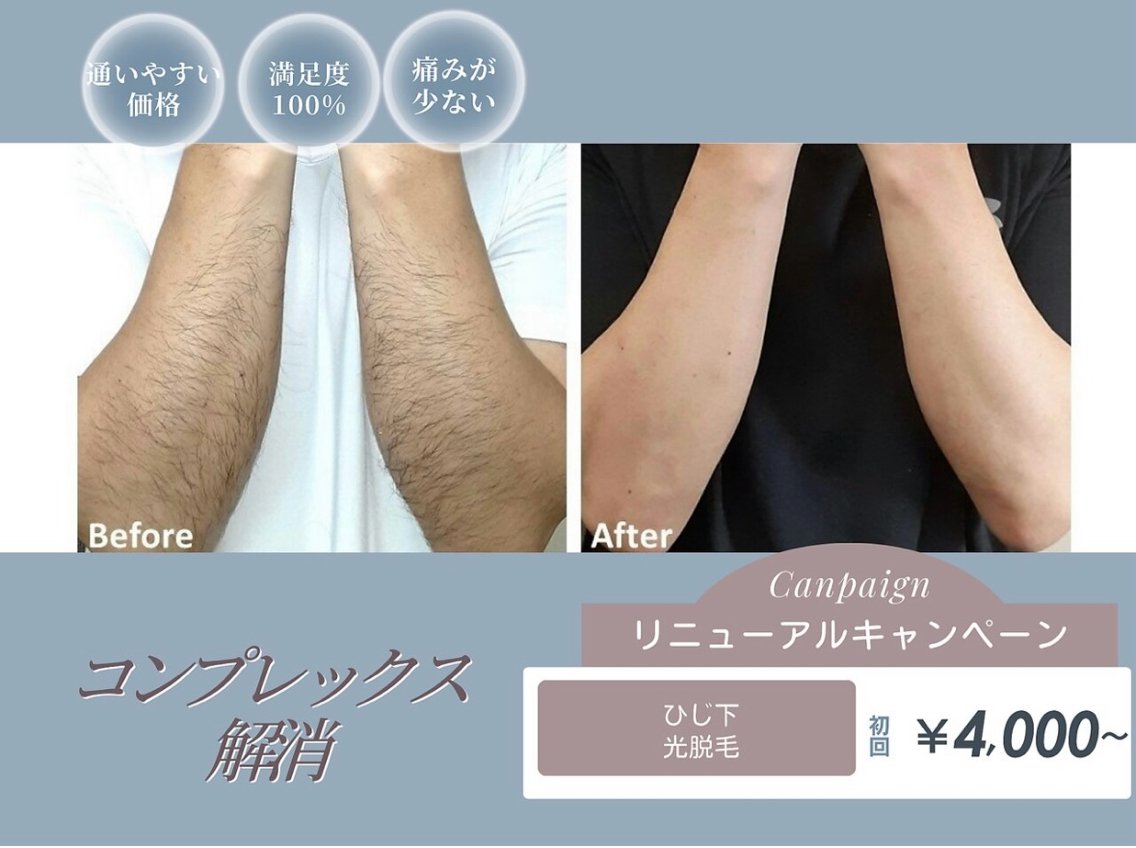 脱毛 アトリエリリー 宅井のエステ・リラクイメージ