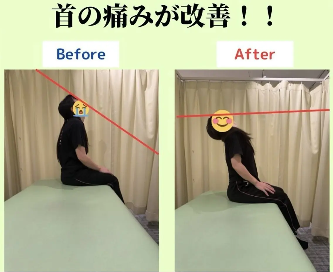 頭・首まわりすっきり整体の写真
