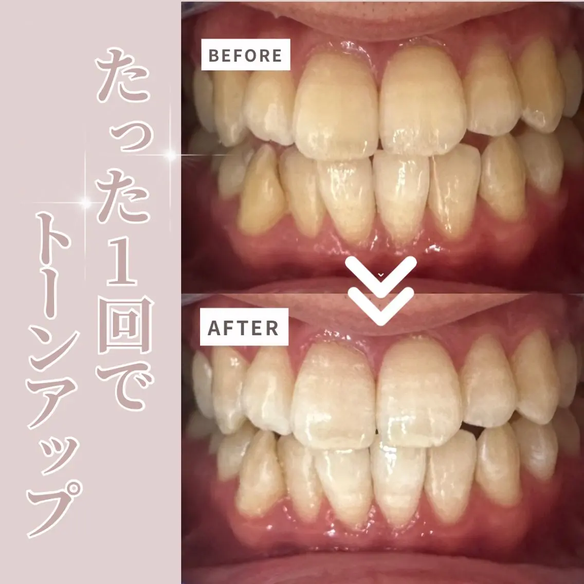 LIBRA自由が丘 ホワイトニングのその他イメージ