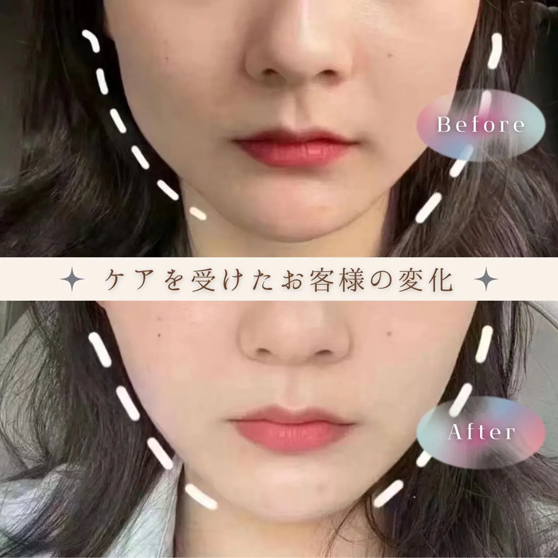 エステ リラク 愛維美水光美肌専門店 メンズレディースokのエステ・リラクイメージ