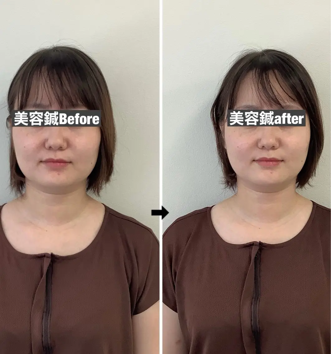 エステ リラク サロンドオフ西梅田店 美容鍼灸・小顔整体のエステ・リラクイメージ