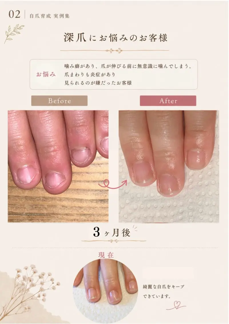 ネイル ジェルネイル ハンドネイル 木村 千晴のネイルデザイン