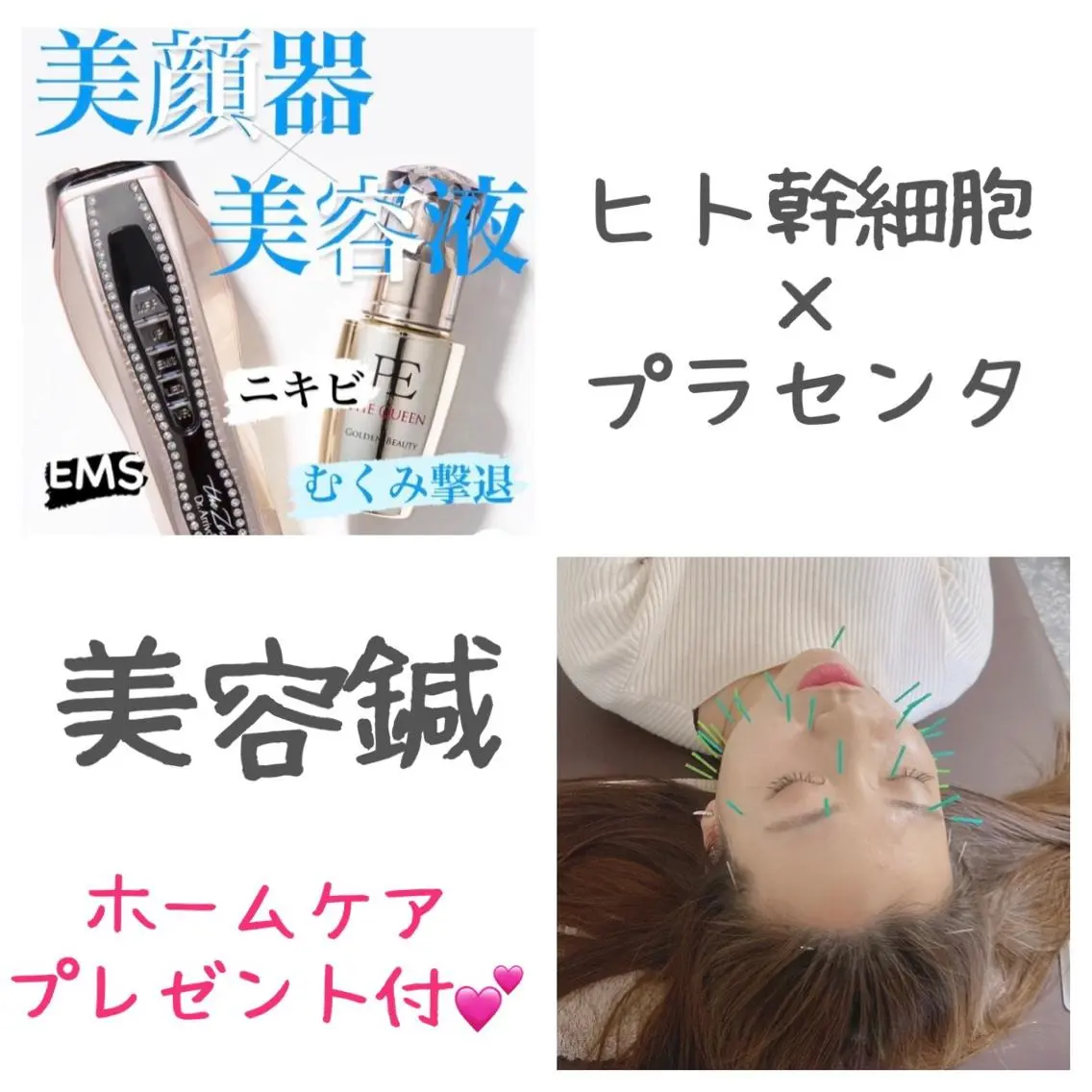 ✨美容鍼+美容鍼ローラー+ヒト幹細胞×プラセンタ美容液導入✨(お持ち帰り美容鍼ローラー付き)先着3名様限定の写真
