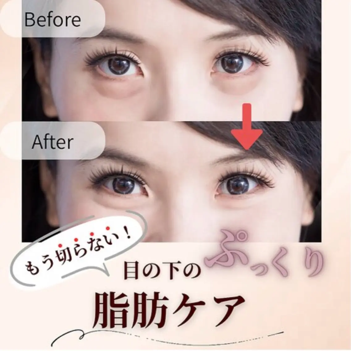 もう切らない！目の下ぷっくり脂肪ケア🎶体験2回の写真