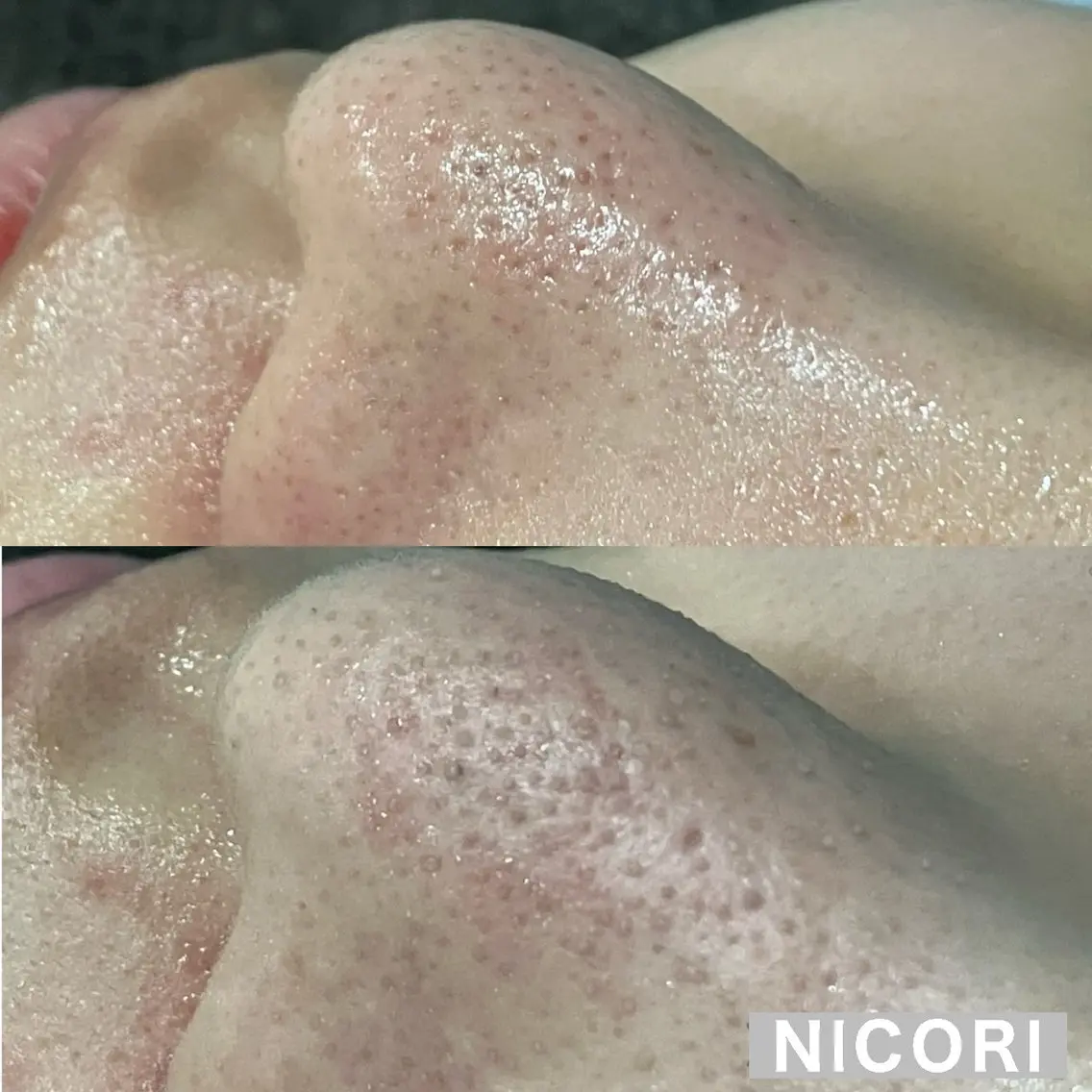 エステ 小顔＆肌質改善 NICORIのエステ・リラクイメージ