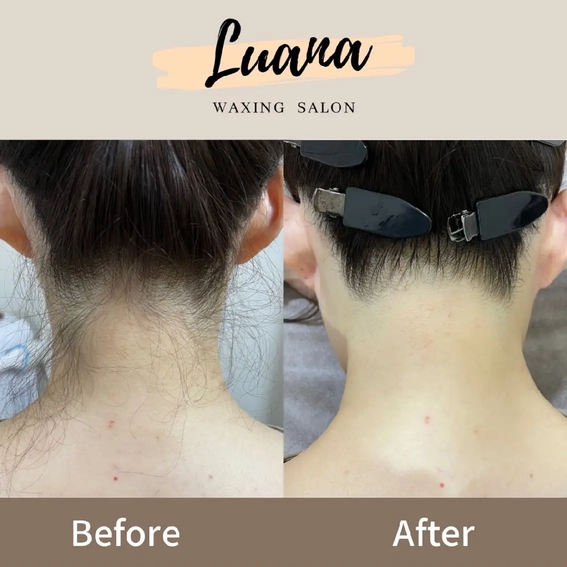 脱毛 Luana wax 🐚根本のエステ・リラクイメージ