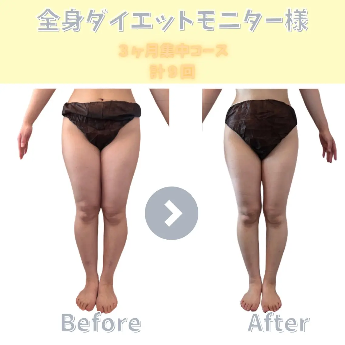 【ダイエット専門店】 エステサロン&Kのエステ・リラクイメージ