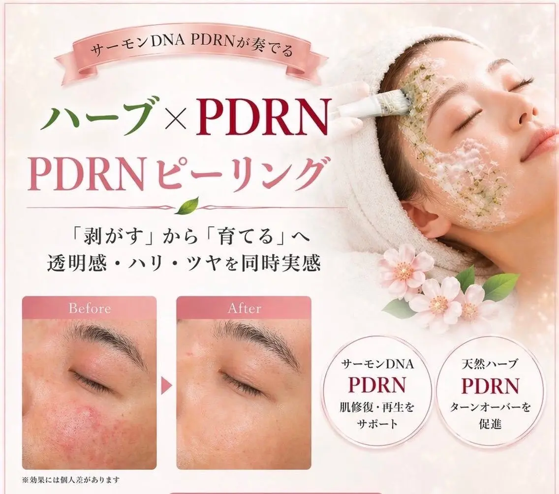 minimo限定価格【韓国で話題の再生美容】PDRN✖️ハーブピーリングで小顔・艶肌へ✨80分¥5,500の写真