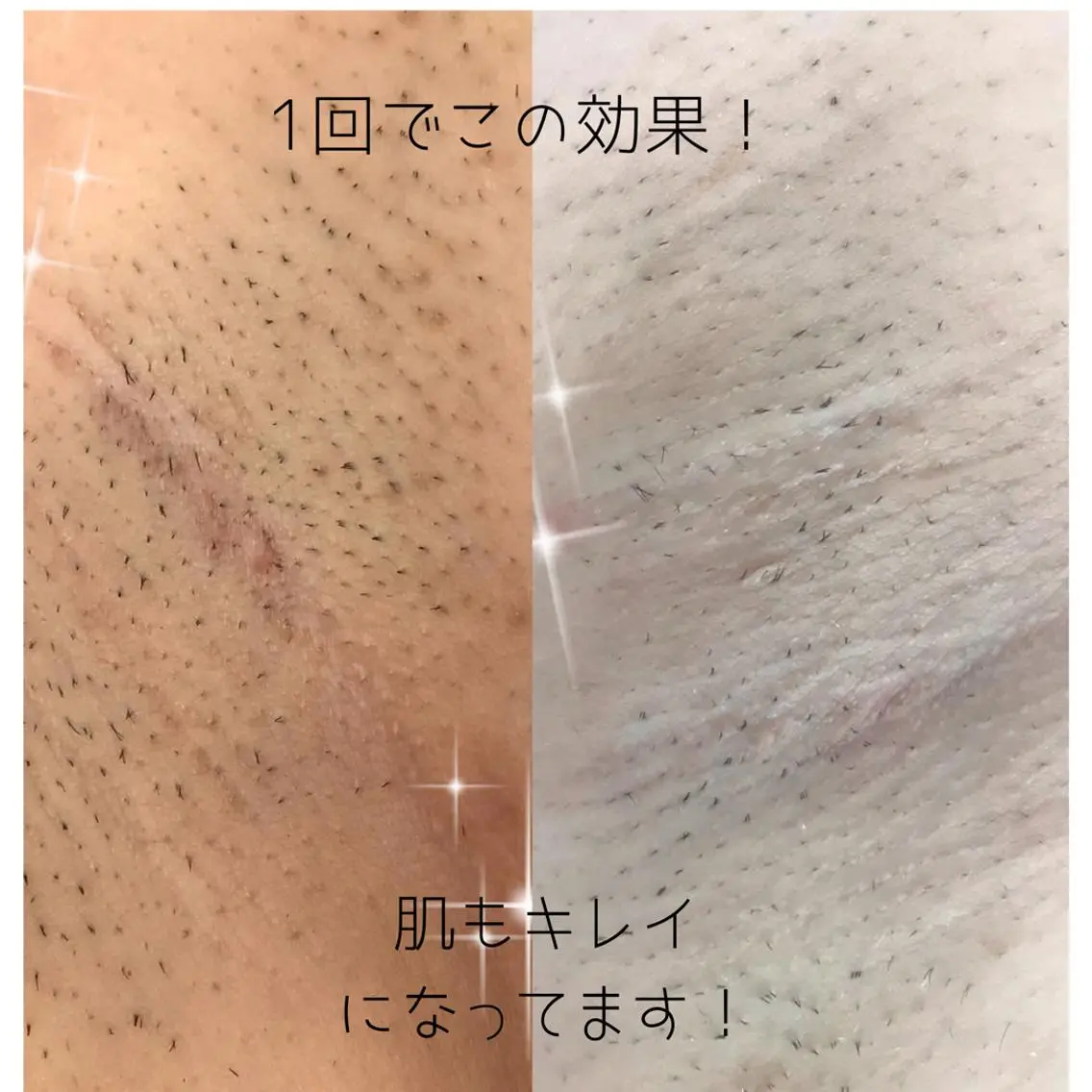 脱毛サロン Plageプラージュのエステ・リラクイメージ