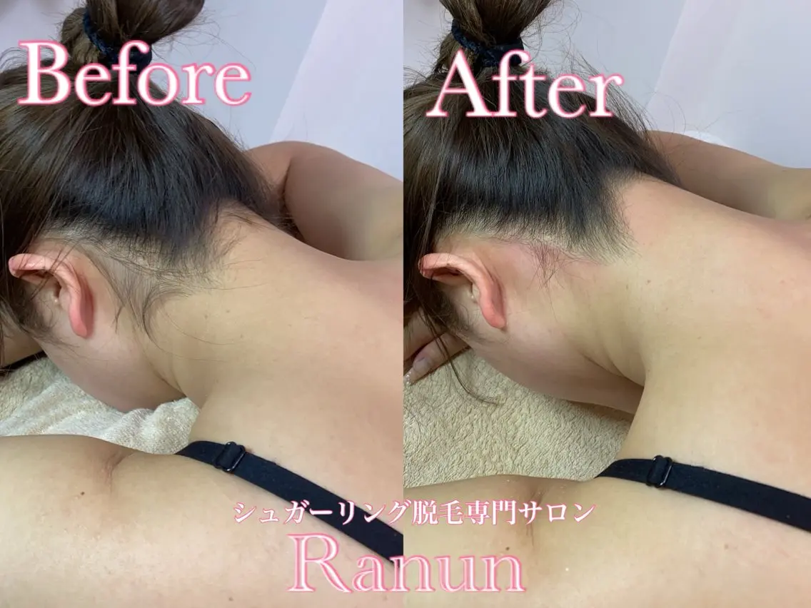 マツエク・マツパ 脱毛 シュガーリング脱毛 専門店Ranunのエステ・リラクイメージ