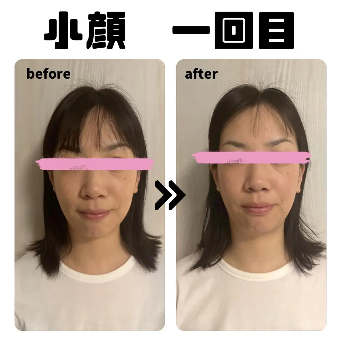 小顔整顔＋遠赤外線ドーム（ミネラルクリーム168使用）の写真