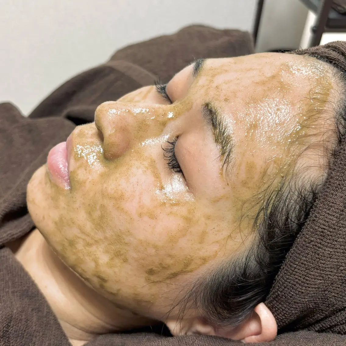 ミニモ限定🫧《剥離なし》ハーブピーリング🌿低刺激で痛くない🩵ダウンタイムなし🪞メンズも歓迎🕊の写真