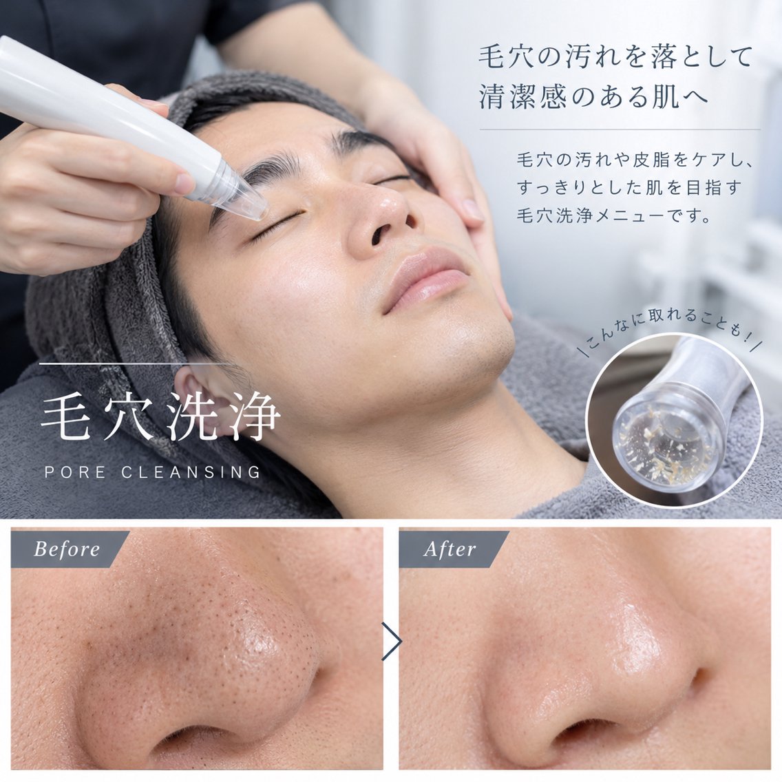 🙂✨メンズ毛穴洗浄✨🙂✨✨お肌とぅるとぅる清潔感アップ✨✨の写真