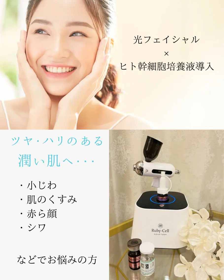 【フェイスラインすっきり、内側からツヤ肌へ】光フェイシャル＋ヒト幹細胞培養液導入の写真