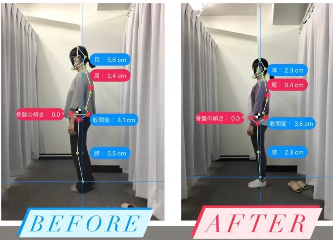 【初回】肩こり・首こり集中整体の写真