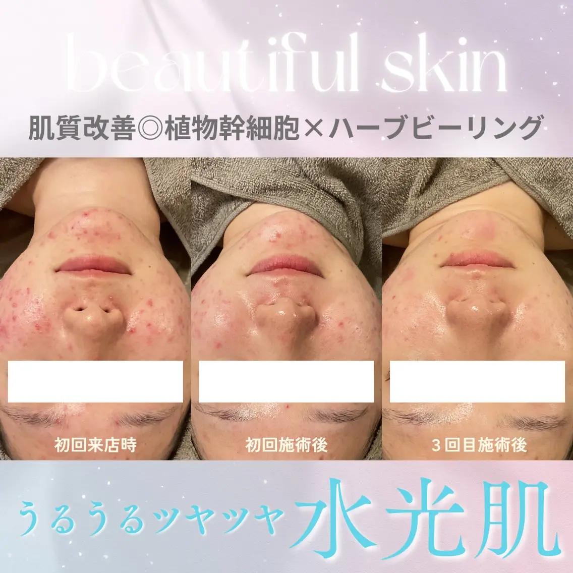 エステ 美肌サロン💎ハーブ ピーリング🌿ルプレのエステ・リラクイメージ
