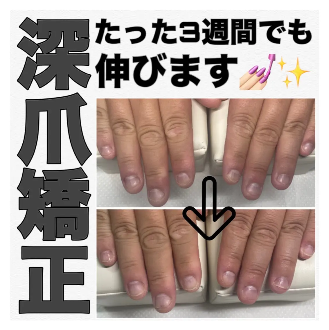 ネイル nail salon petillantのネイルデザイン