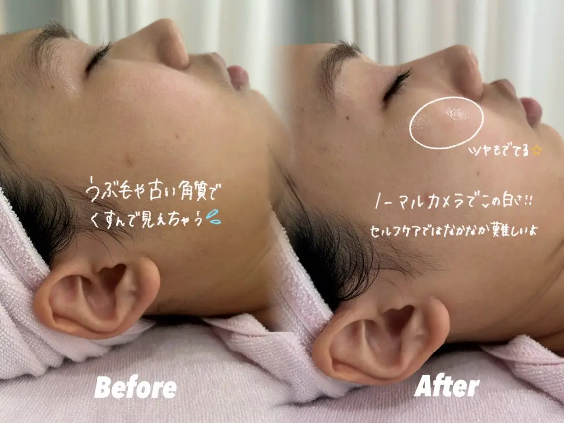🫧美しい素肌へ🫧 今成柚乃のその他イメージ