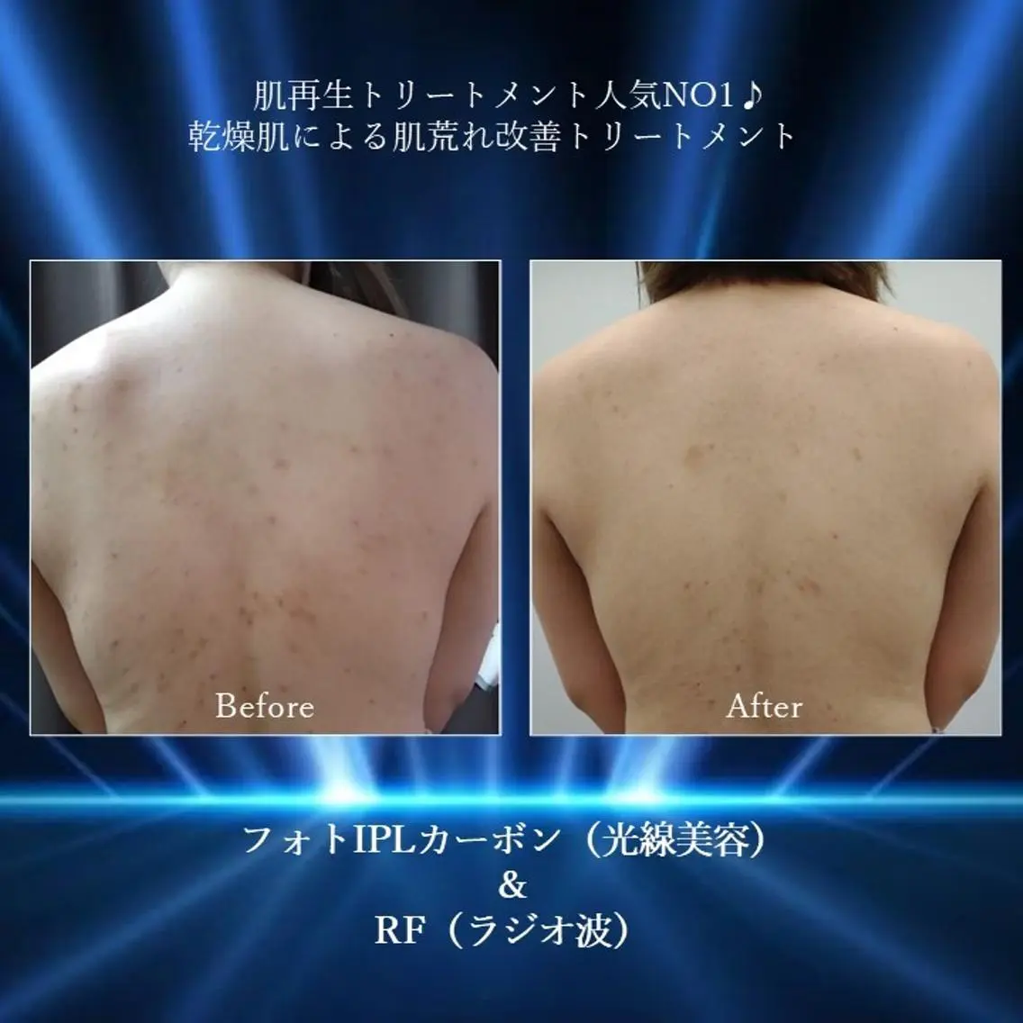 エステ ふじわら ひかりのエステ・リラクイメージ