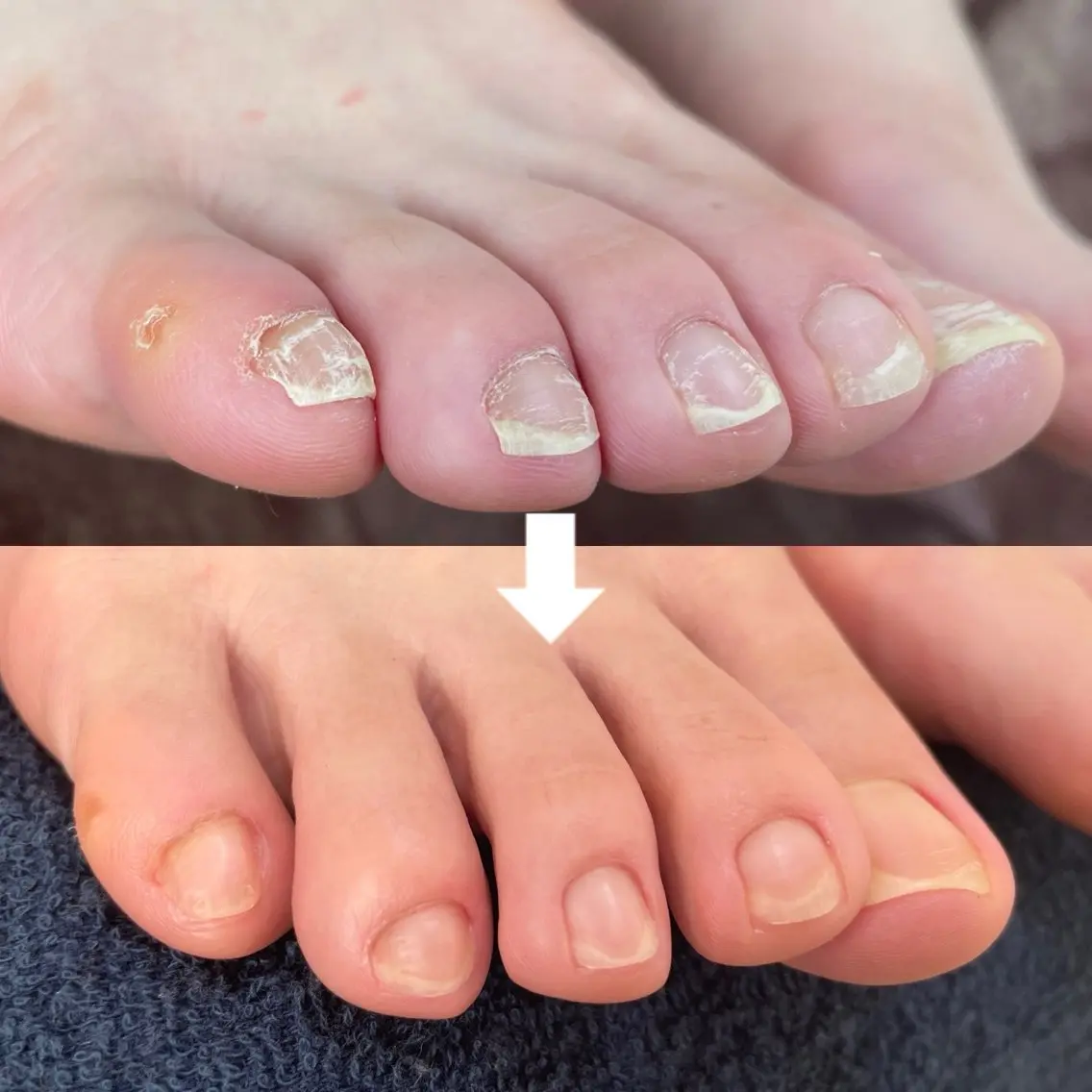 フットネイル たちばな ✋🦶💆♀️のネイルデザイン