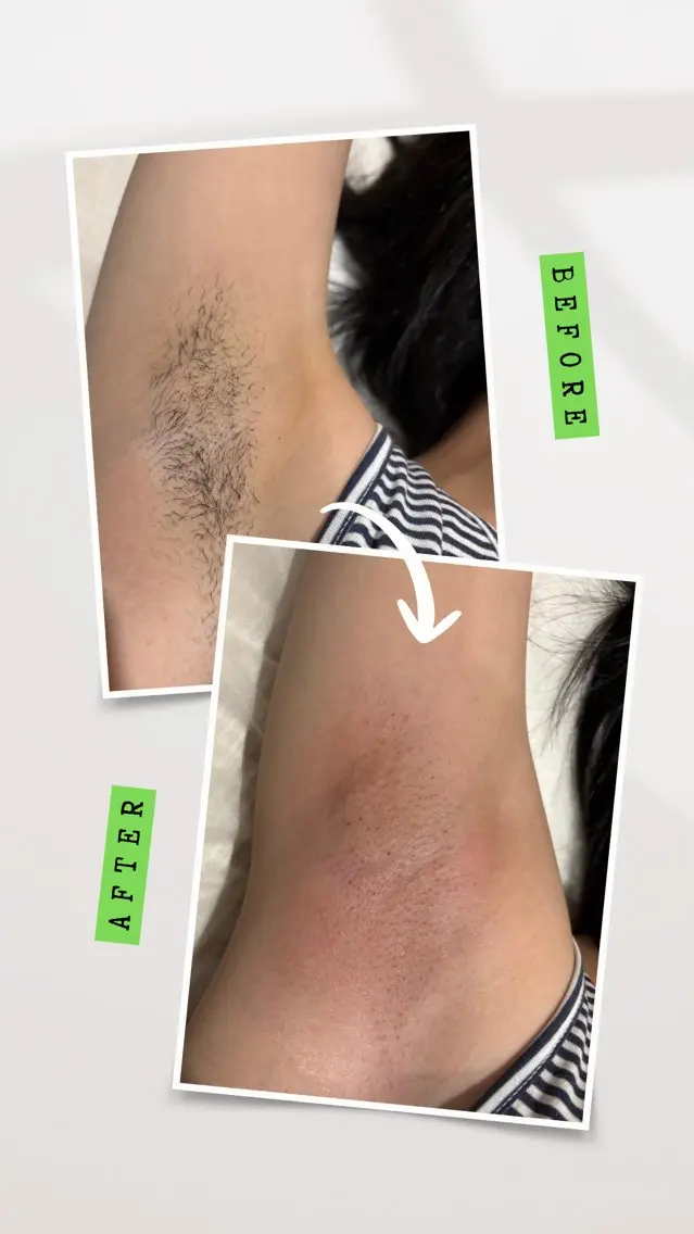 SUGARING SALON Limaのエステ・リラクイメージ