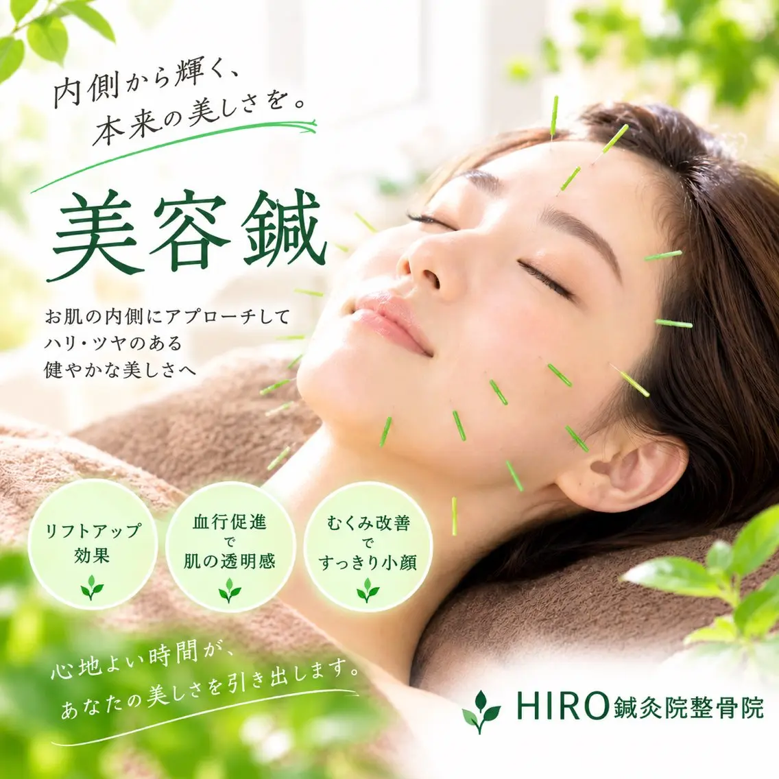 美容鍼の写真