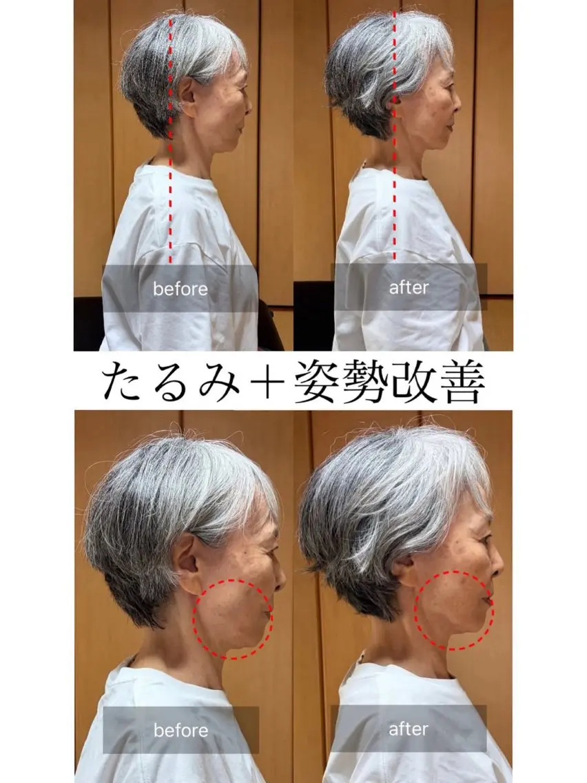 【姿勢＆フェイスライン改善】小顔矯正＋姿勢矯正50分 価格：3980円の写真