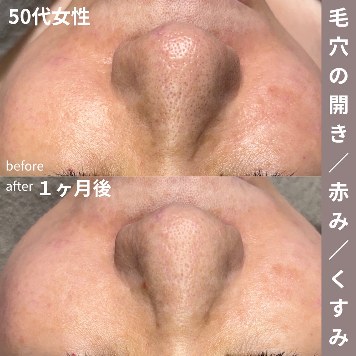 毛穴／肌管理サロン B SKINのエステ・リラクイメージ
