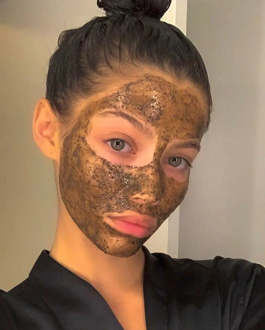 ✧ダウンタイムなし次世代ハーブピーリング　ニキビ、ニキビあと、シミ、たるみ、毛穴に◎プラセンタor コラーゲンパック付の写真