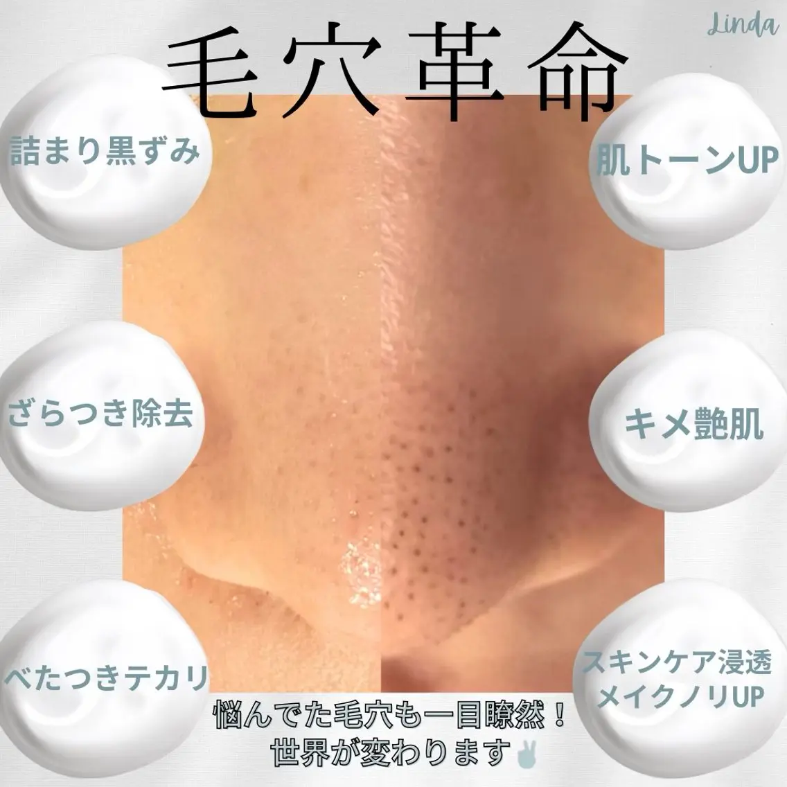 エステ 小顔&毛穴・肌質改善 LINDA西宮 AIのその他イメージ