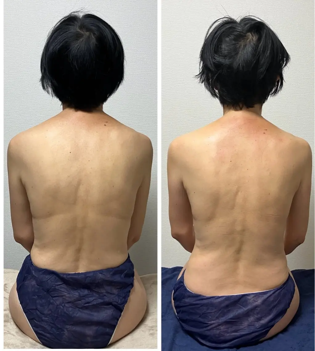 【minimo限定🧡ྀི】全身ほぐし+肩甲骨+CBDオイルデコルテネックヘッド60分の写真