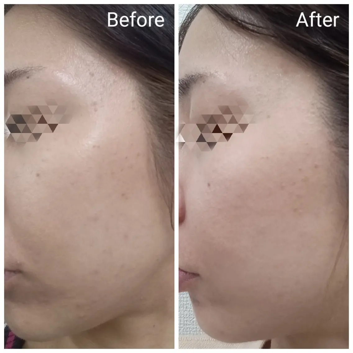 肌質改善Beauty salon Renのエステ・リラクイメージ
