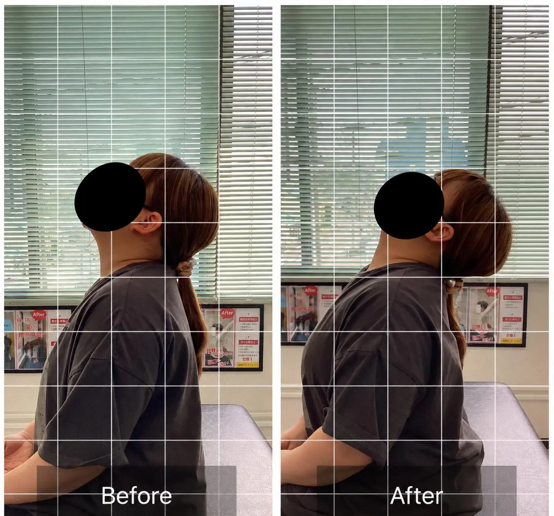 【初回】猫背･姿勢ケア整体の写真
