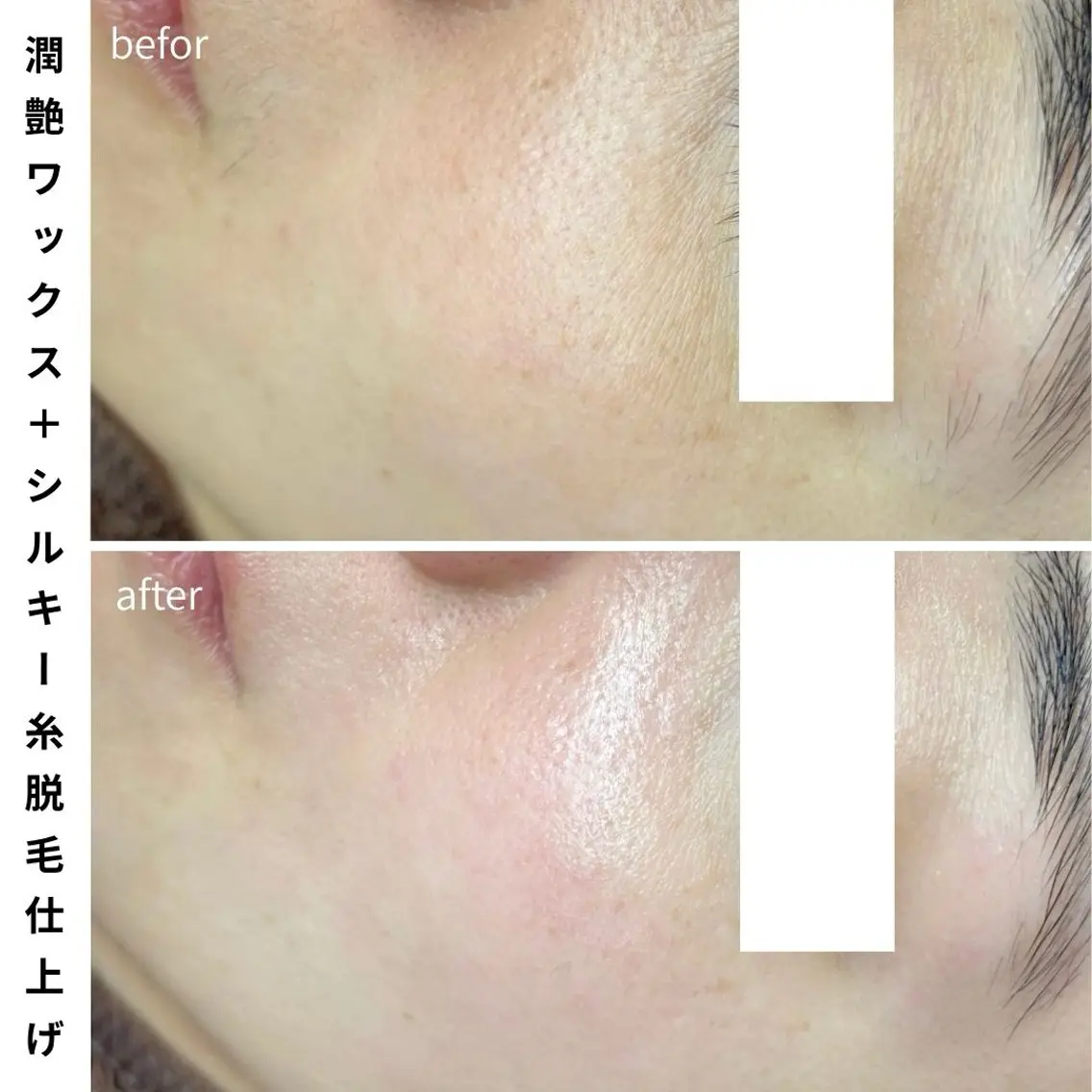 脱毛 Muqu. 毛穴サロンのエステ・リラクイメージ