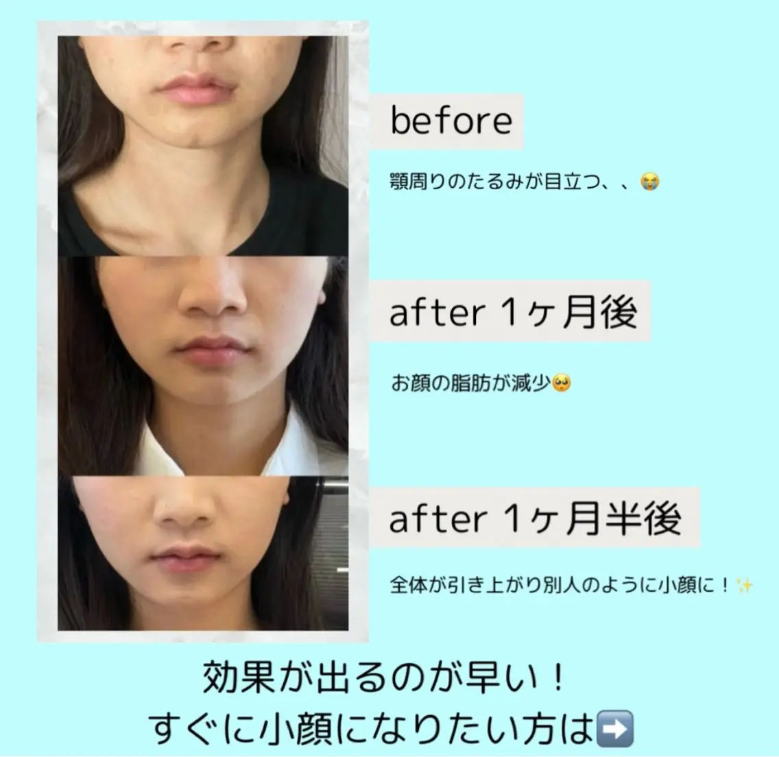 エステ リラク 愛維美水光美肌専門店 メンズレディースokのエステ・リラクイメージ