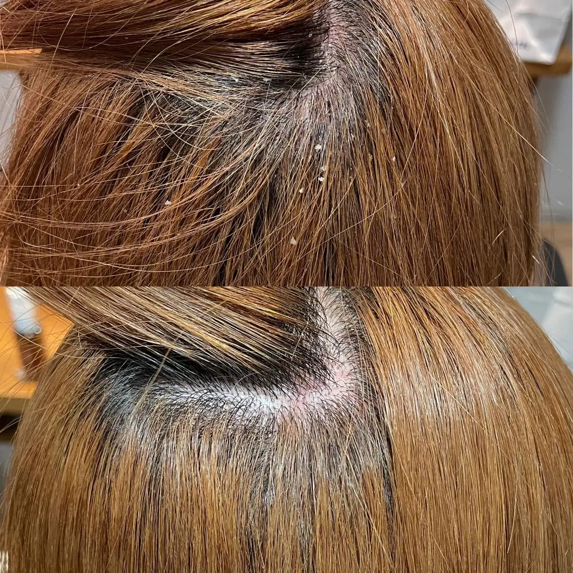 頭皮改善ヘッドスパ体験の写真