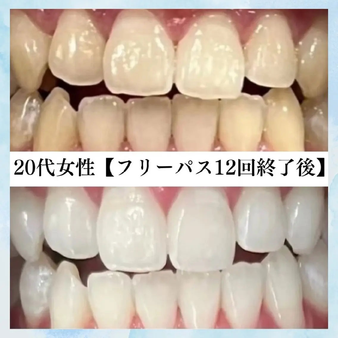 メンズ キッズ エステ リラク セルフホワイトニング WHITE福岡博多店のエステ・リラクイメージ